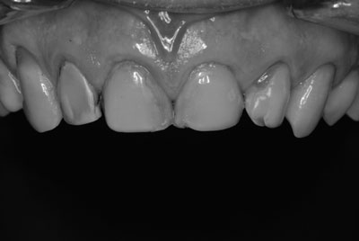 Teeth Closeup